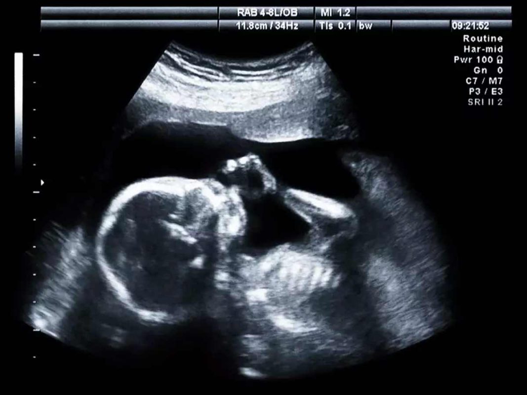 Clínica Girona launches a new Fetal Echocardiography service