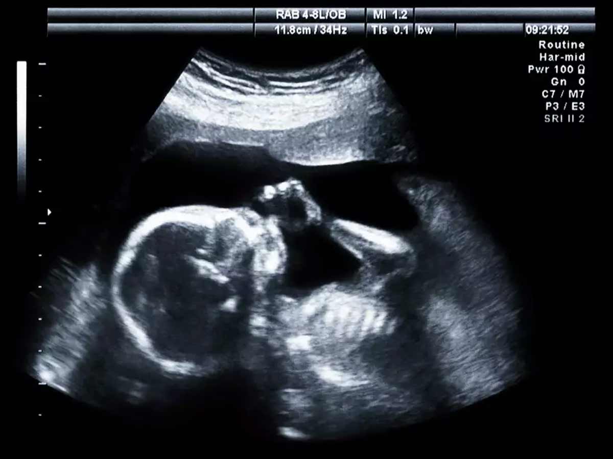 Clínica Girona posa en funcionament un nou servei d’Ecocardiografia Fetal